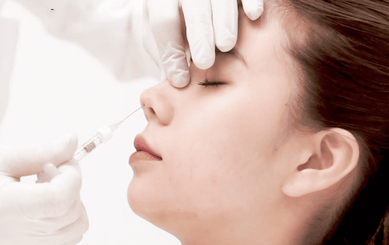 6. Khi nào cần hòa tan filler trước phẫu thuật và khi nào không?