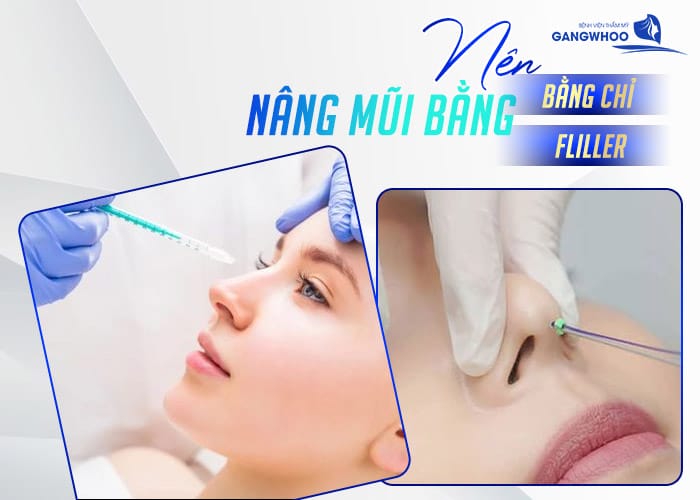 Quy trình nâng mũi phẫu thuật (tổng quan)