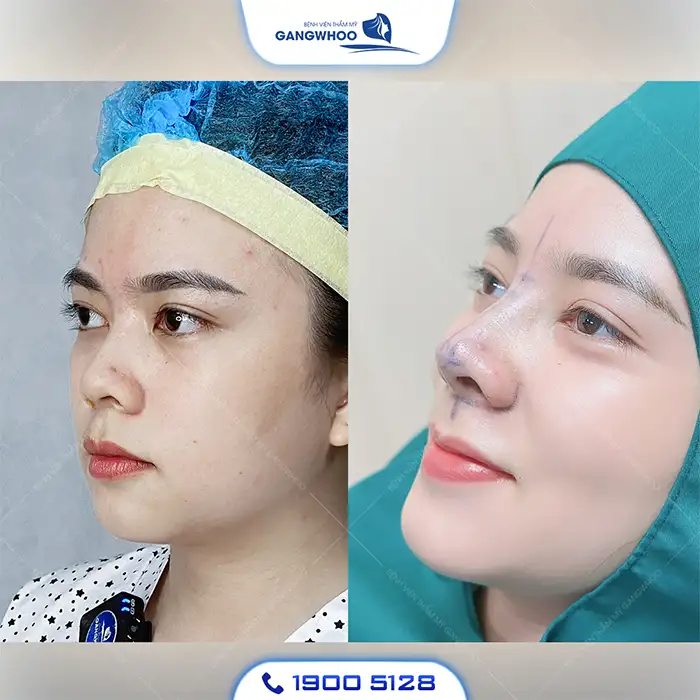Sự khác biệt quan trọng khi đưa ra quyết định (ai phù hợp với phương án nào?)