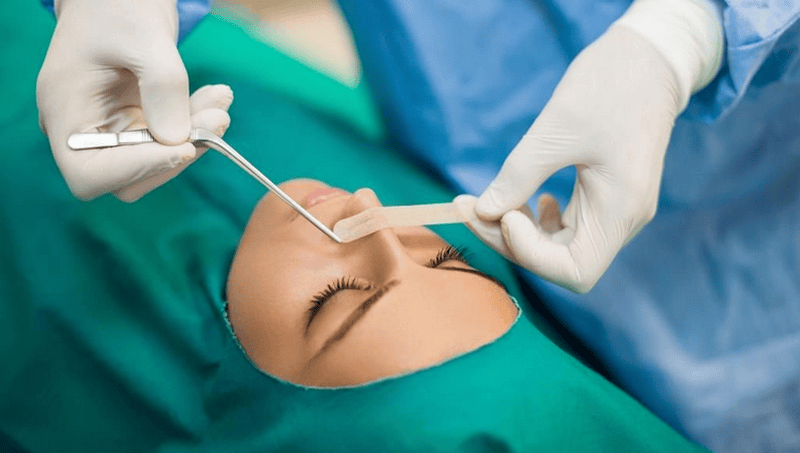 Bên cạnh sản phẩm: điều gì quan trọng hơn — kỹ thuật hay thương hiệu filler?