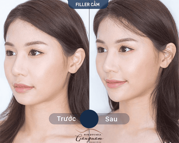 Lộ trình chăm sóc sau thủ thuật — những lưu ý bắt buộc