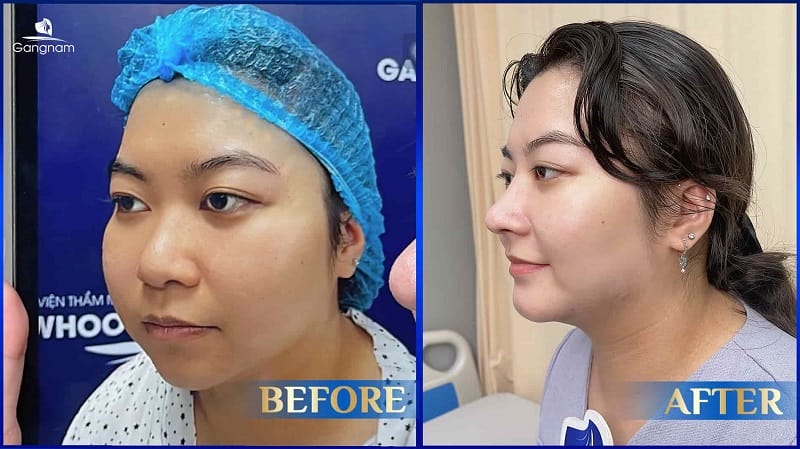 Quy trình đánh giá và quyết định: bác sĩ sẽ cân nhắc những yếu tố nào?