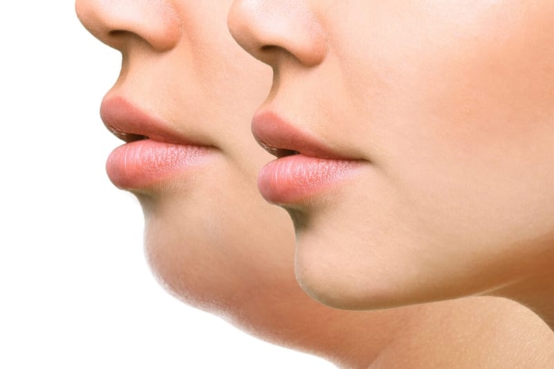 So sánh nhanh để quyết định (Checklist trước khi chọn)