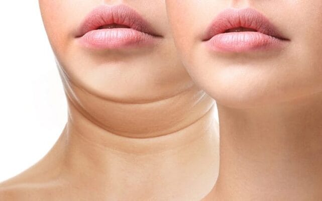 Nếu vẫn phân vân: quy trình khám và điều trị an toàn tại clinic chuyên khoa nên là gì?