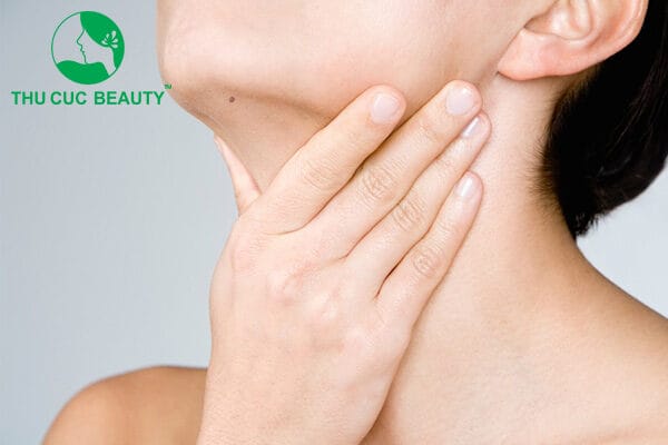 Quy trình chăm sóc sau khi loại nốt ruồi ẩn dưới cằm — cần lưu ý gì?