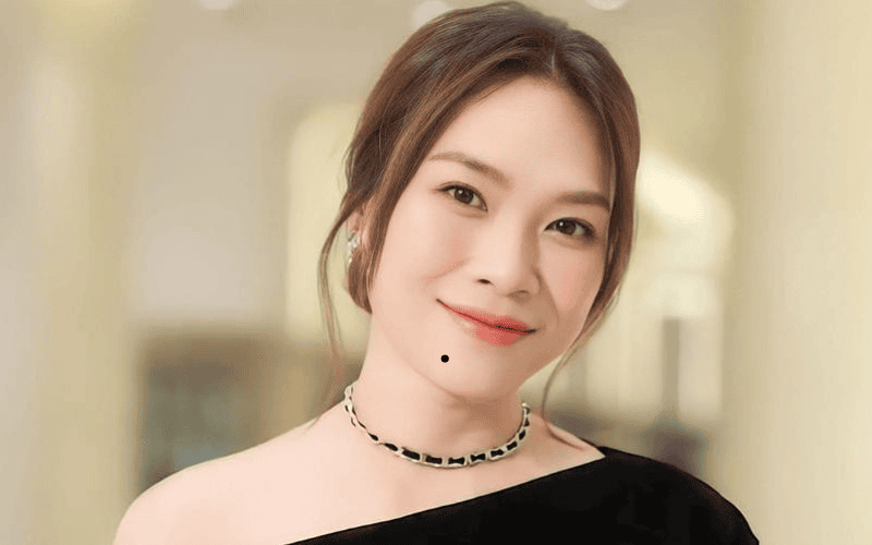 Lời khuyên thực tế dành cho chị em đang cân nhắc loại bỏ nốt ruồi ẩn dưới cằm