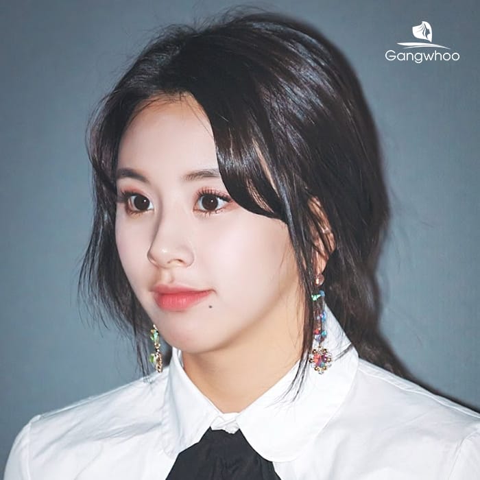Nốt ruồi ẩn dưới cằm là gì — nó khác nốt ruồi bình thường như thế nào?