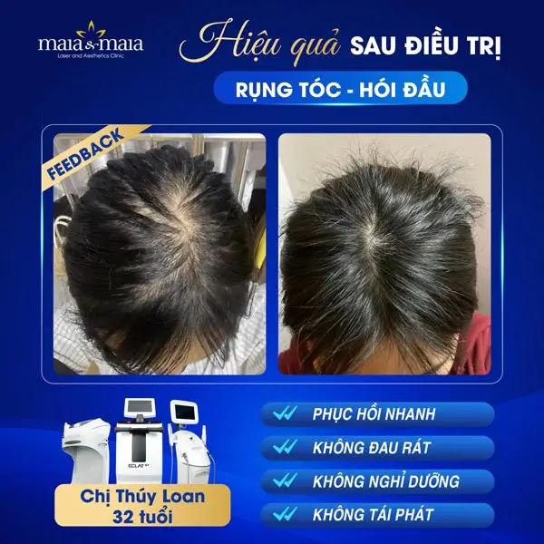 Liệu pháp tại phòng khám: PRP, microneedling, LLLT, tế bào gốc/exosome