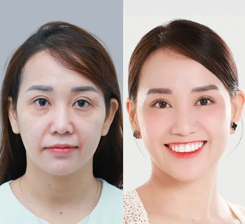 Cơ chế lão hóa liên quan đến tuổi thọ kết quả