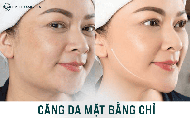 Có phương pháp không phẫu thuật nào thay thế hoặc kéo dài hiệu quả được không?