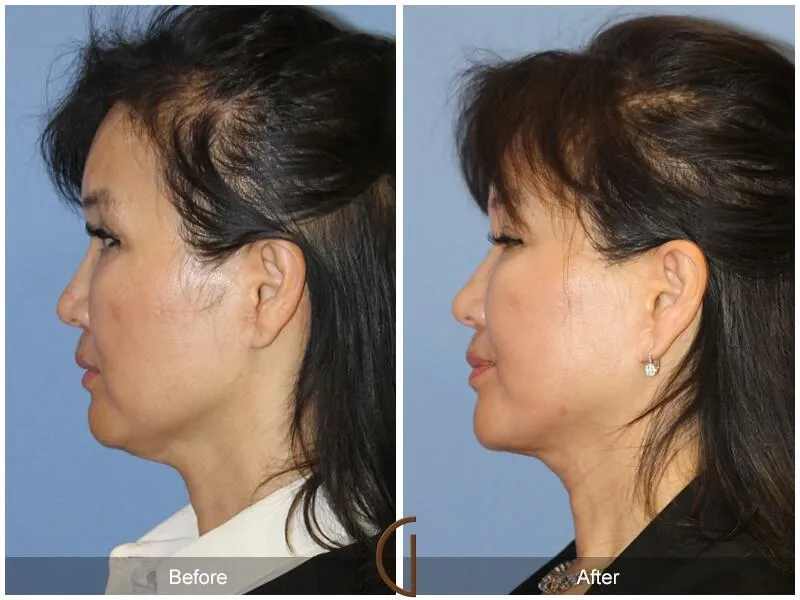 Những câu hỏi thường gặp thực tế trước khi quyết định