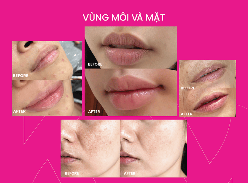Những rủi ro, tác dụng phụ và khi nào cần hoãn điều trị?