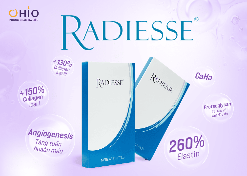 So sánh Radiesse và filler hyaluronic acid — Khi nào nên chọn loại nào?
