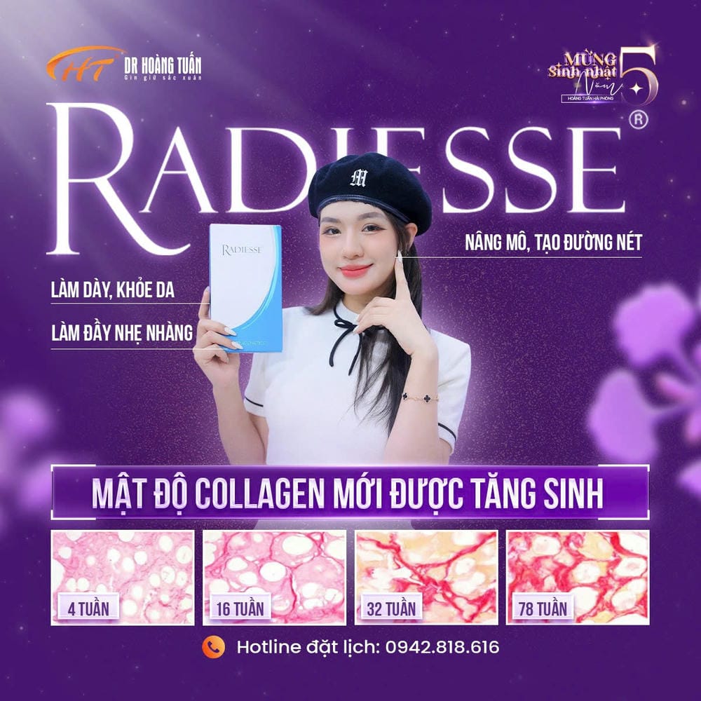 Bước quy trình tiêm Radiesse tại clinic như thế nào?