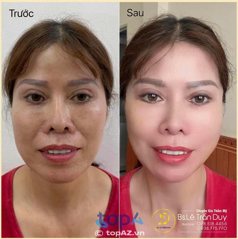 Khi nào cần liên hệ bác sĩ?