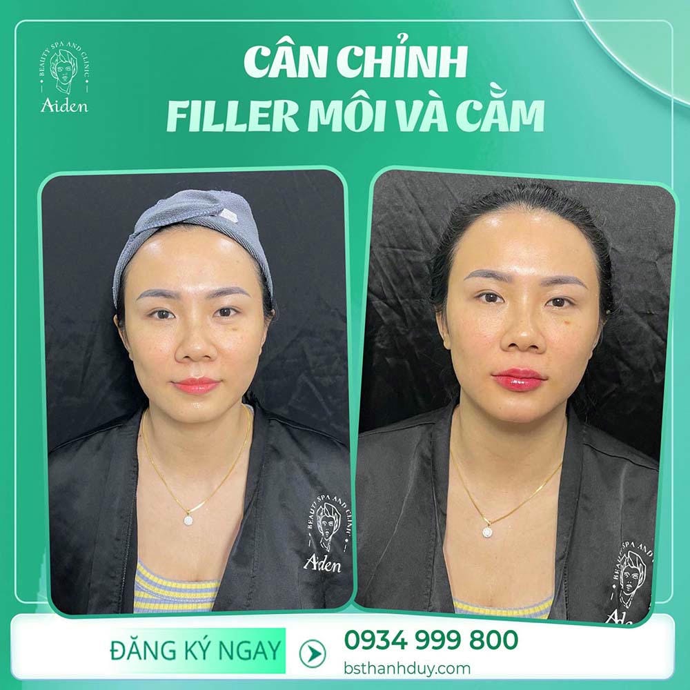 Bước xử trí nếu nghi ngờ tắc mạch khi dùng HA