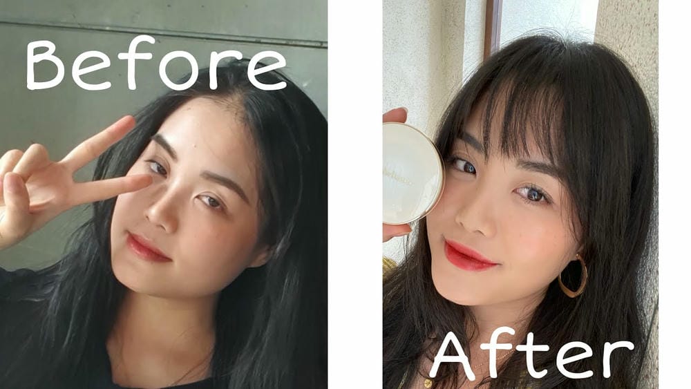 Quy trình tiêm botox masseter an toàn — chuẩn tại clinic