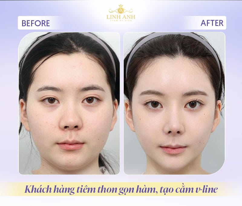 Ai phù hợp/không phù hợp — tiêu chí chọn nơi tiêm và bác sĩ?