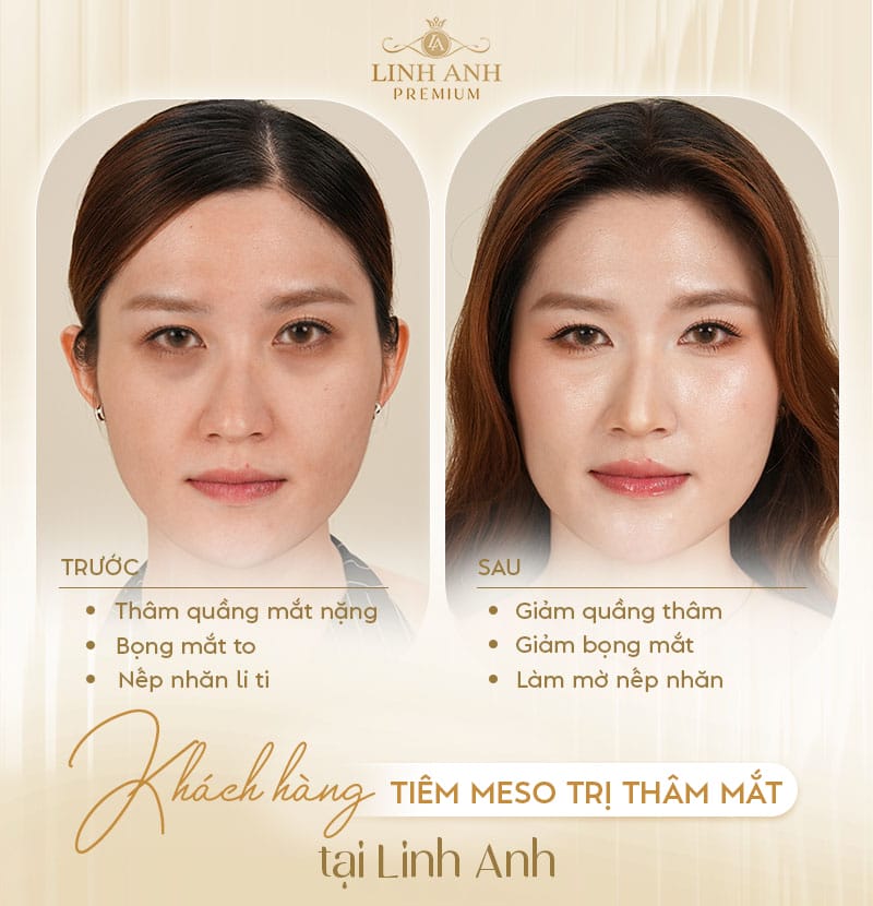 Rủi ro và tác dụng phụ — điều gì có thể xảy ra và khi nào phải liên hệ bác sĩ ngay?
