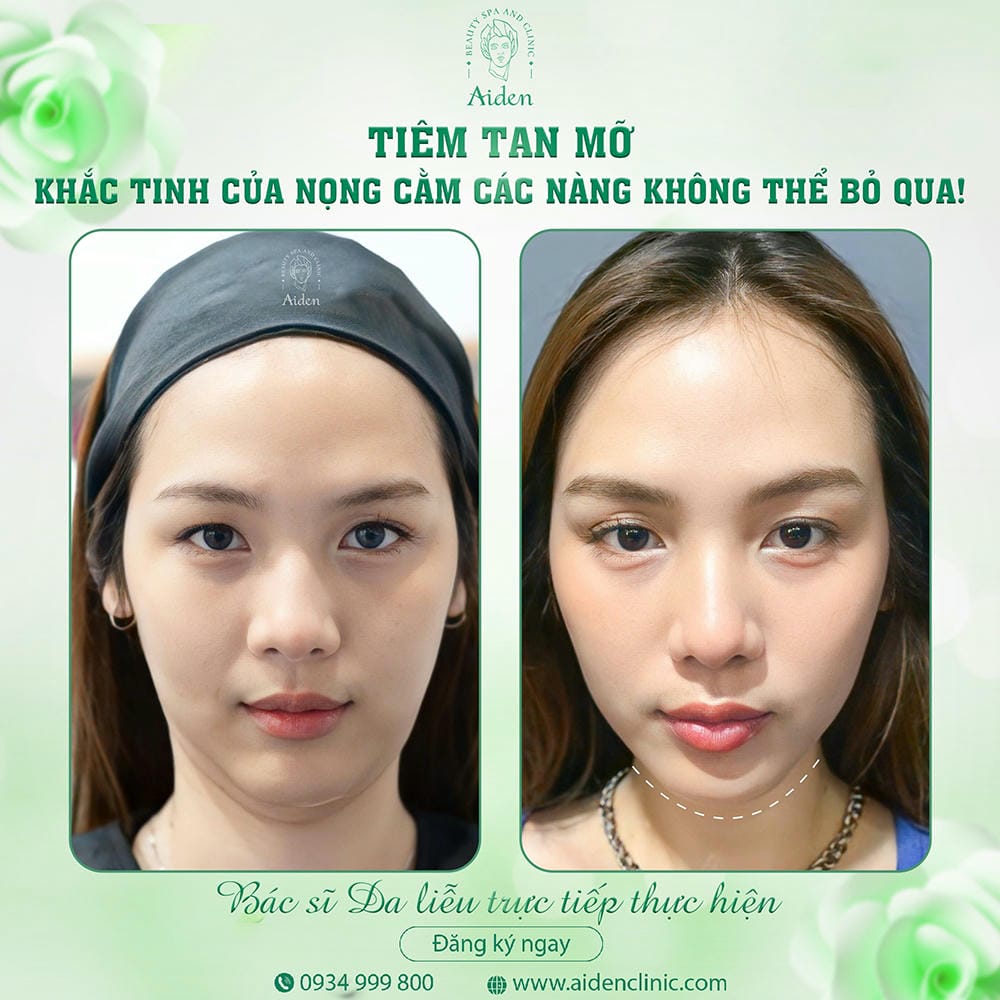 So sánh thực tế: tiêm tan mỡ vs hút mỡ vs các phương pháp không xâm lấn (HIFU, sóng RF, laser)