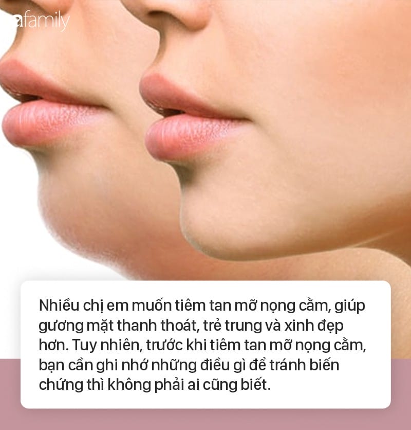 Bằng chứng lâm sàng và hiệu quả Kybella nọng cằm nói gì?