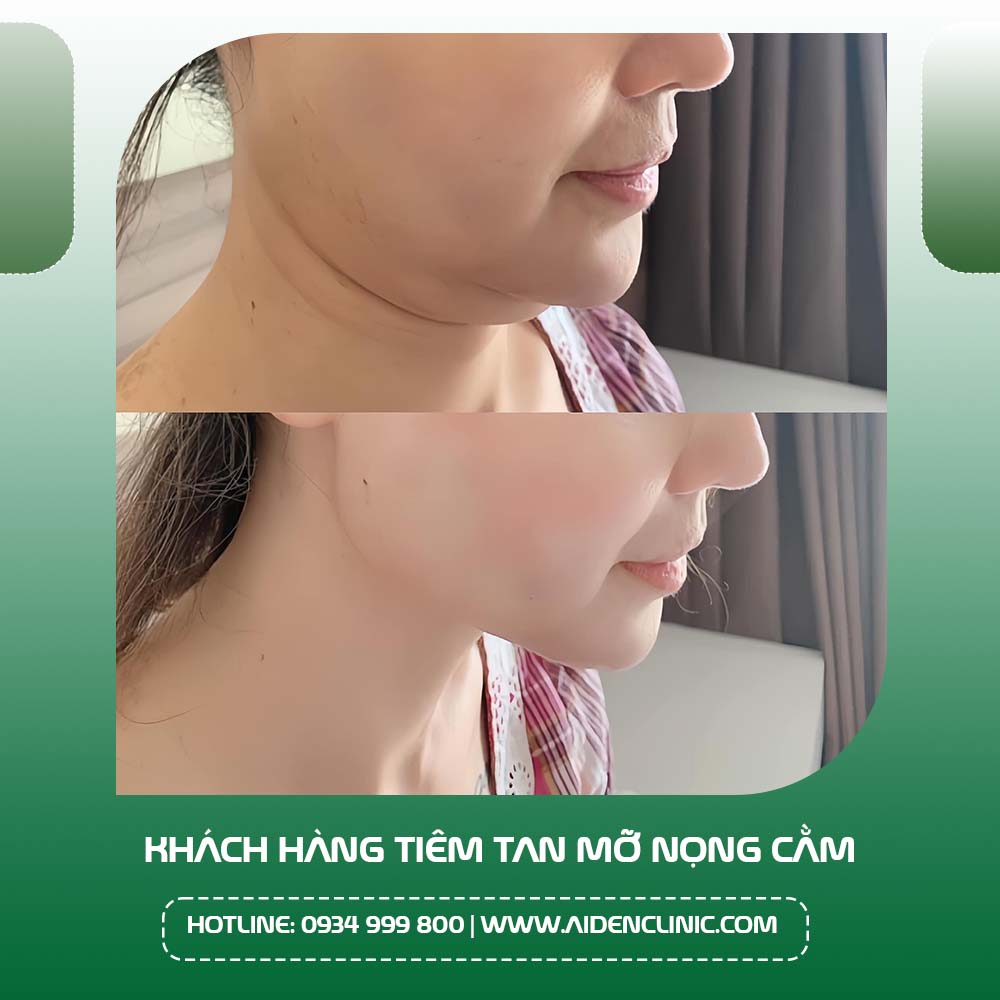 Bí quyết chọn cơ sở và bác sĩ để giảm rủi ro và đạt kết quả tự nhiên?