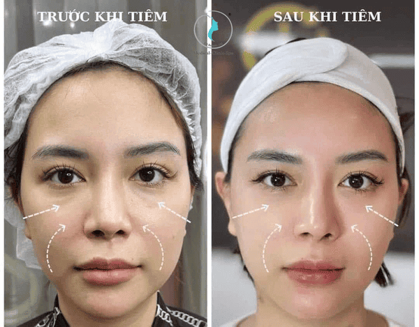 Hiệu quả và bằng chứng lâm sàng: có khác biệt lớn không?