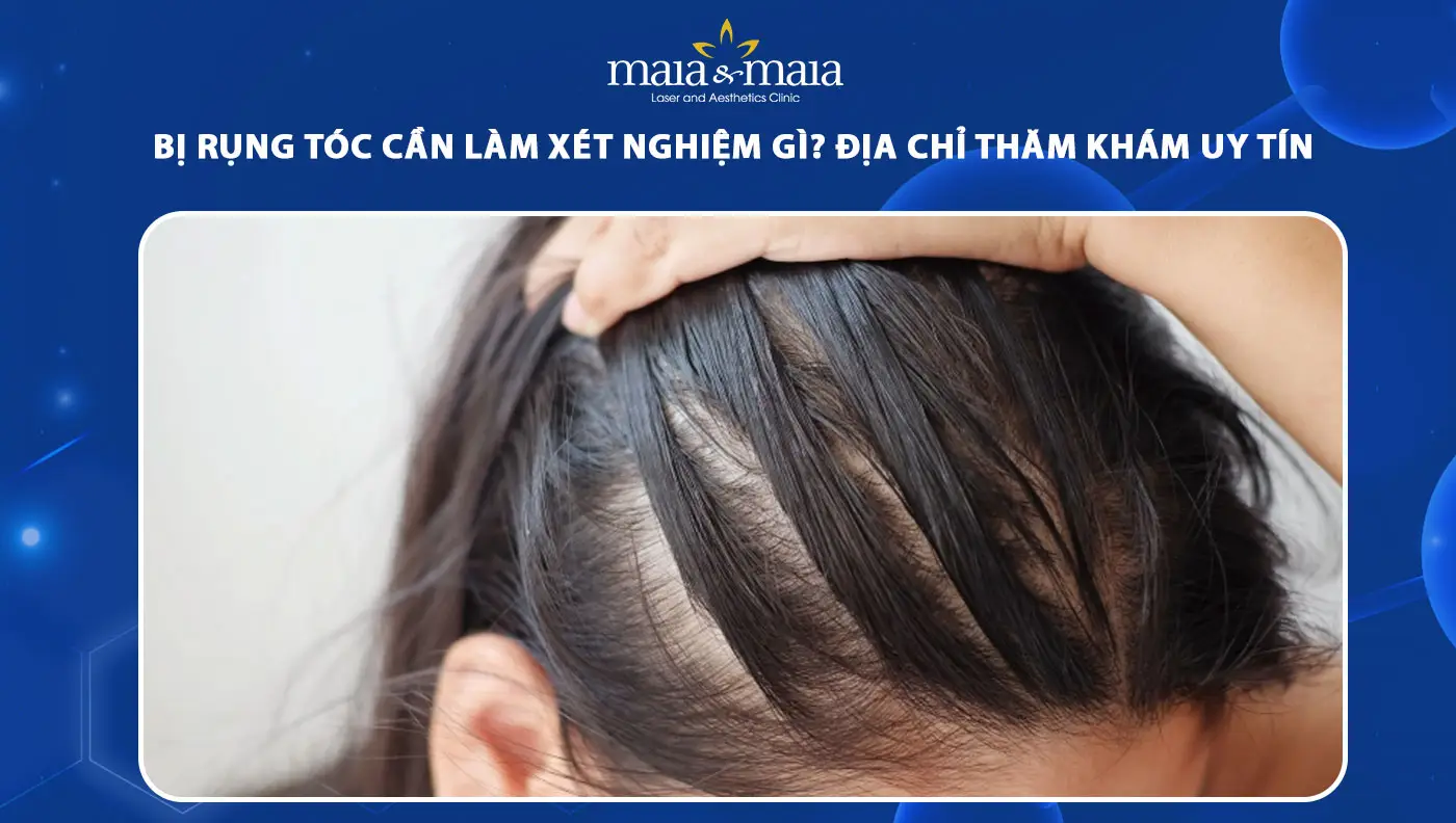 Nếu muốn cấy tóc: kiểm tra những gì trước khi đồng ý phẫu thuật?