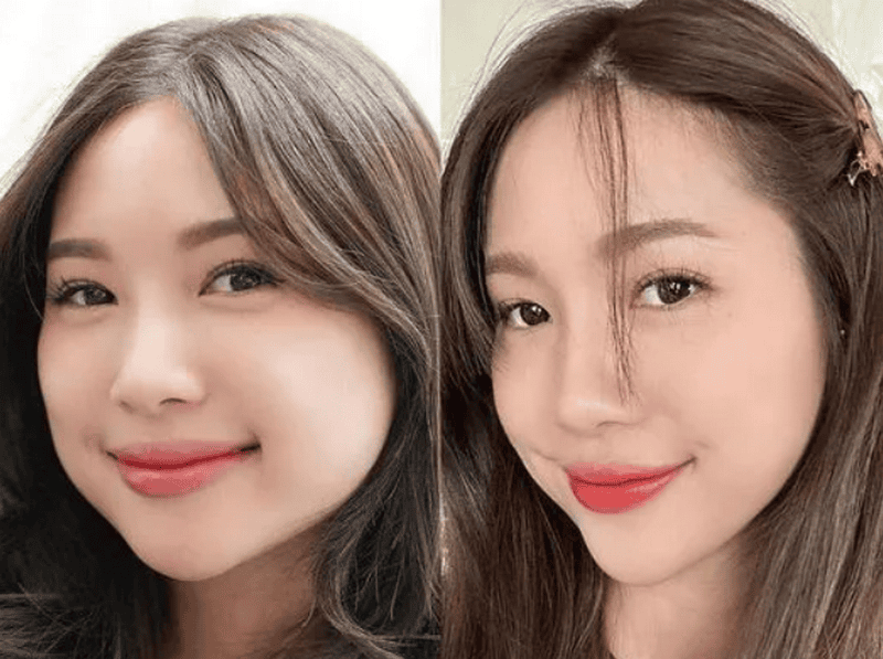 Những triệu chứng thường gặp sau tiêm là gì — và khi nào cần gọi bác sĩ?