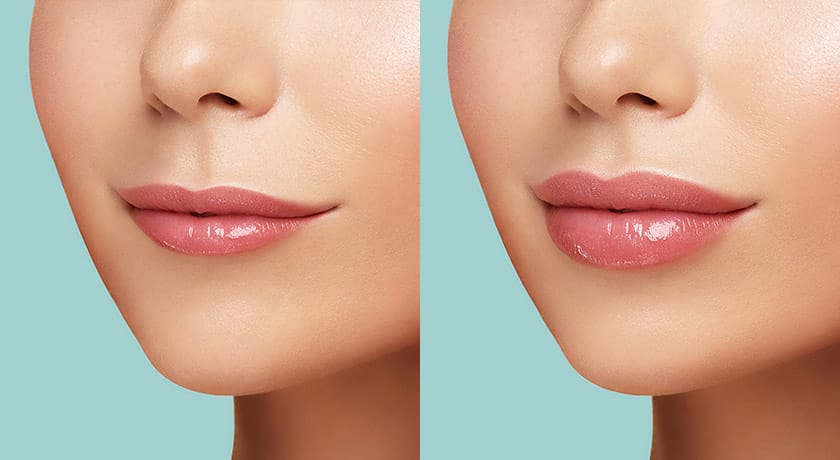 Những câu hỏi thường gặp mà nhiều khách hàng quan tâm