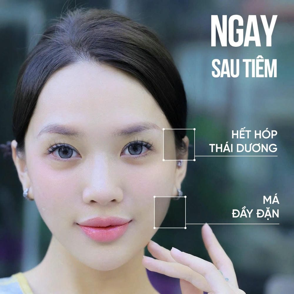 So sánh theo vùng: môi, mũi, rãnh mũi má