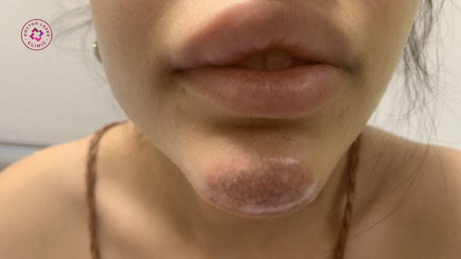 Nếu sưng không giảm hoặc có dấu hiệu bất thường, phòng khám sẽ làm gì?