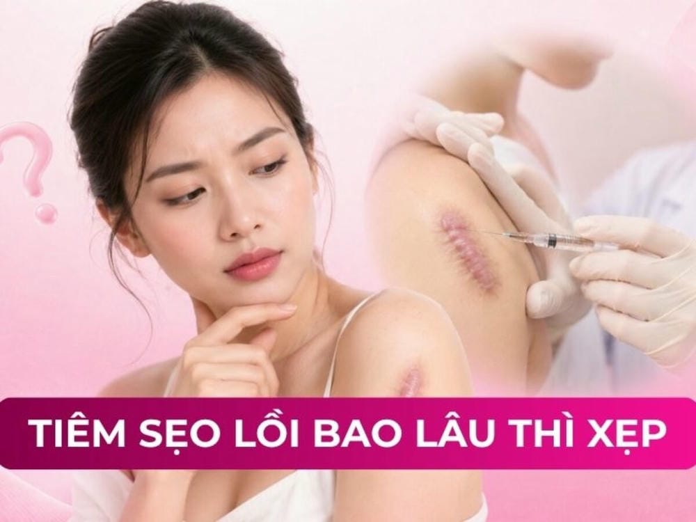 Kết quả mong đợi và khoảng thời gian cần kiên nhẫn là bao lâu?