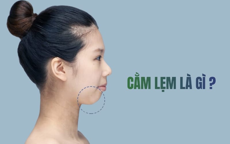 Quy trình an toàn khi điều trị thiếu cằm bằng filler hoặc phẫu thuật nên gồm những bước nào?