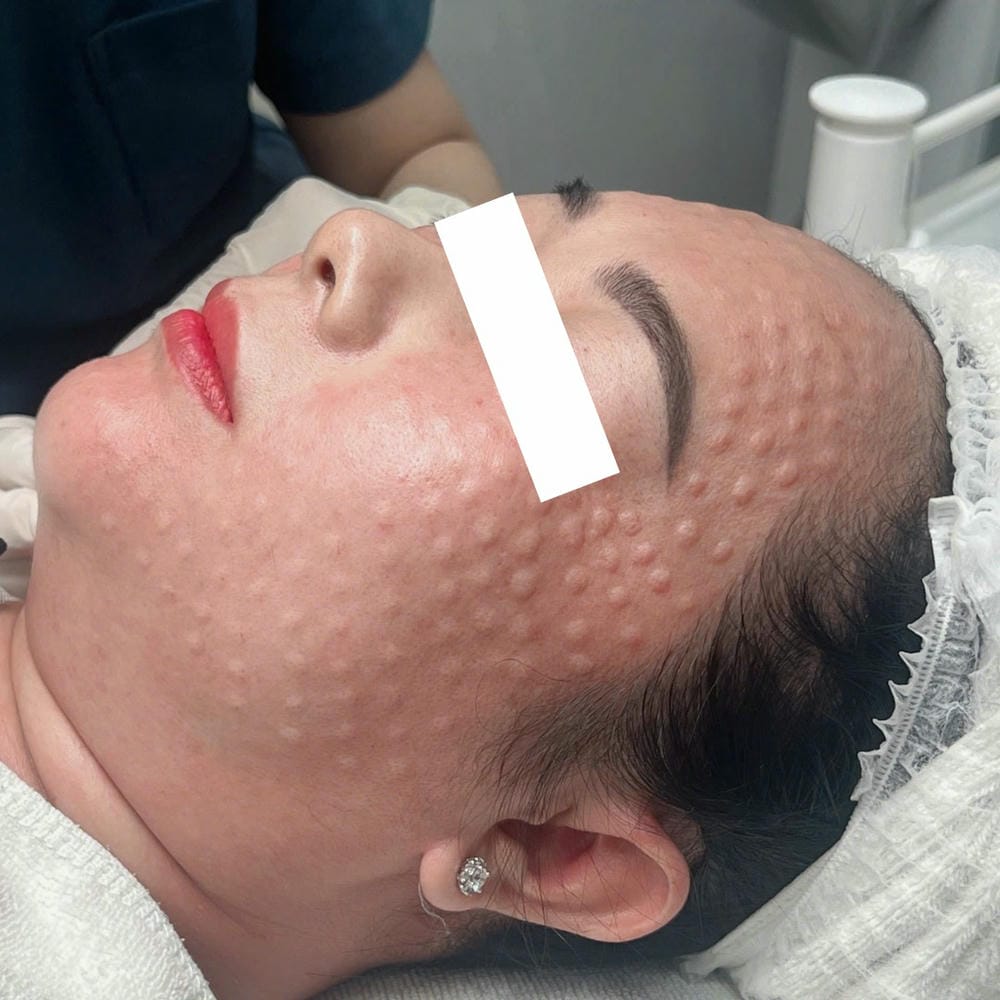 Cơ chế liên quan đến rủi ro