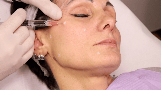 Tiêm BAP so với filler, kỹ thuật mesotherapy và PRP — Nên chọn phương pháp nào cho vấn đề của mình?