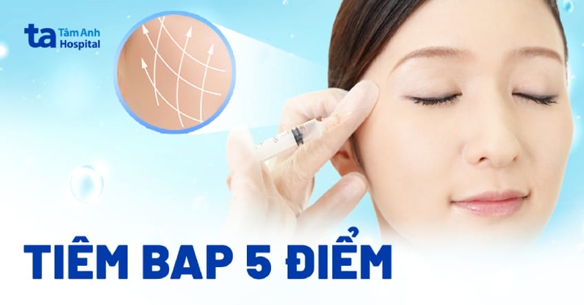 Ai là người phù hợp nhất để cân nhắc tiêm BAP 5 điểm?