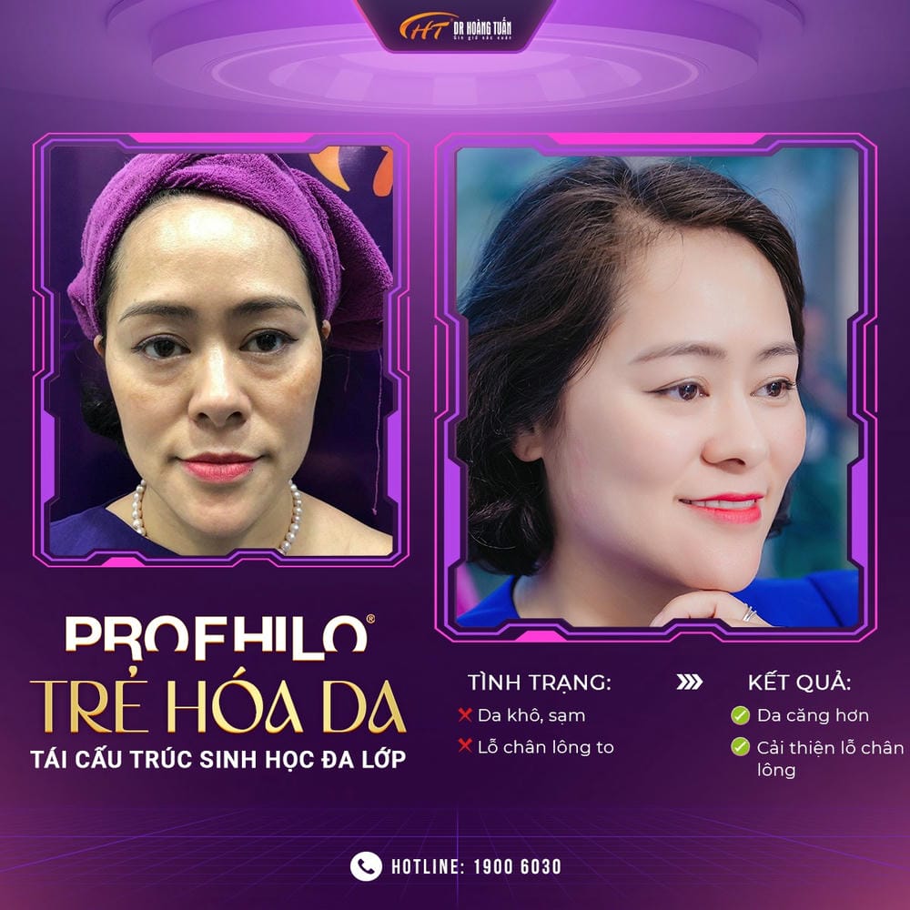 Quy trình tiêm BAP thực hiện như thế nào và cần bao lâu?