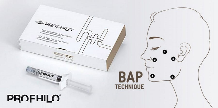Ai không nên tiêm Profhilo hoặc Jalupro?