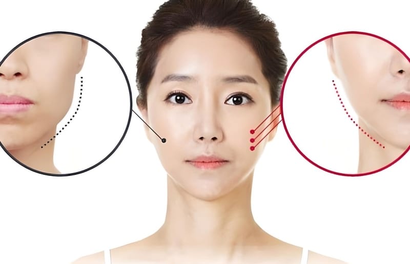Ai dễ sưng hơn và những yếu tố làm tăng rủi ro?