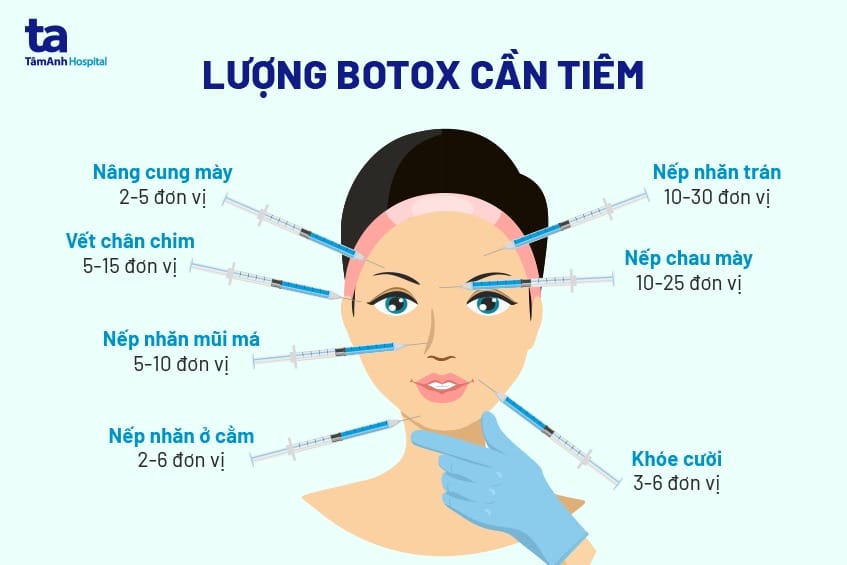Ai không nên tiêm Botox và những chống chỉ định cần biết?