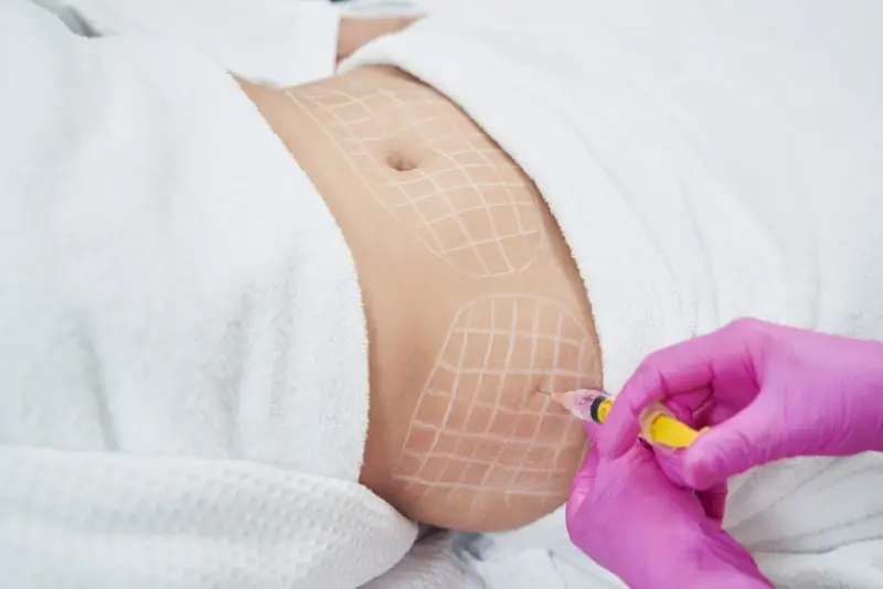 So sánh nhanh: tiêm botox (BTX‑A) — tiêm tan mỡ — hút mỡ — công nghệ không phẫu thuật khác