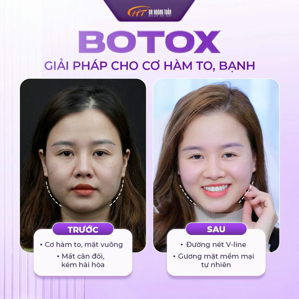 Bạn nên chuẩn bị và chăm sóc thế nào để kéo dài hiệu quả?