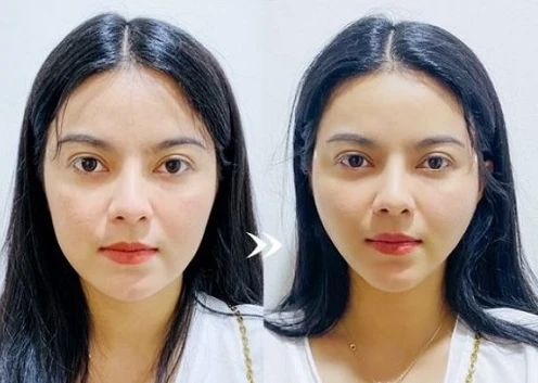 Ghi chú kỹ thuật ngắn