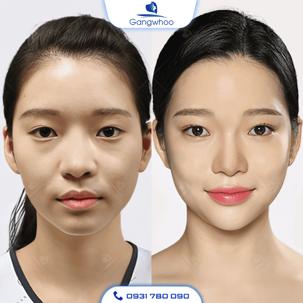 Hiệu quả thấy được sau bao lâu và duy trì được bao lâu?
