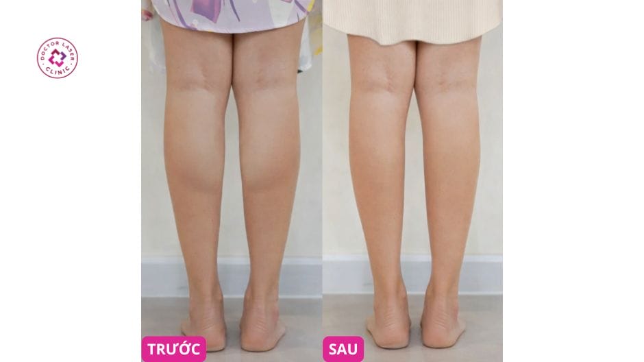 Bảo dưỡng kết quả: tần suất tiêm và điều chỉnh thói quen tập luyện