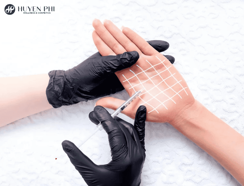 Làm sao để chọn nơi tiêm botox ngăn mồ hôi an toàn và đáng tin cậy?