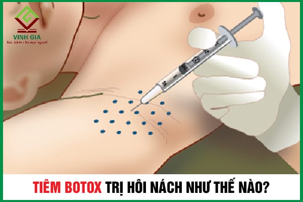 Bằng chứng lâm sàng quan trọng nào nên tham khảo trước khi quyết định?