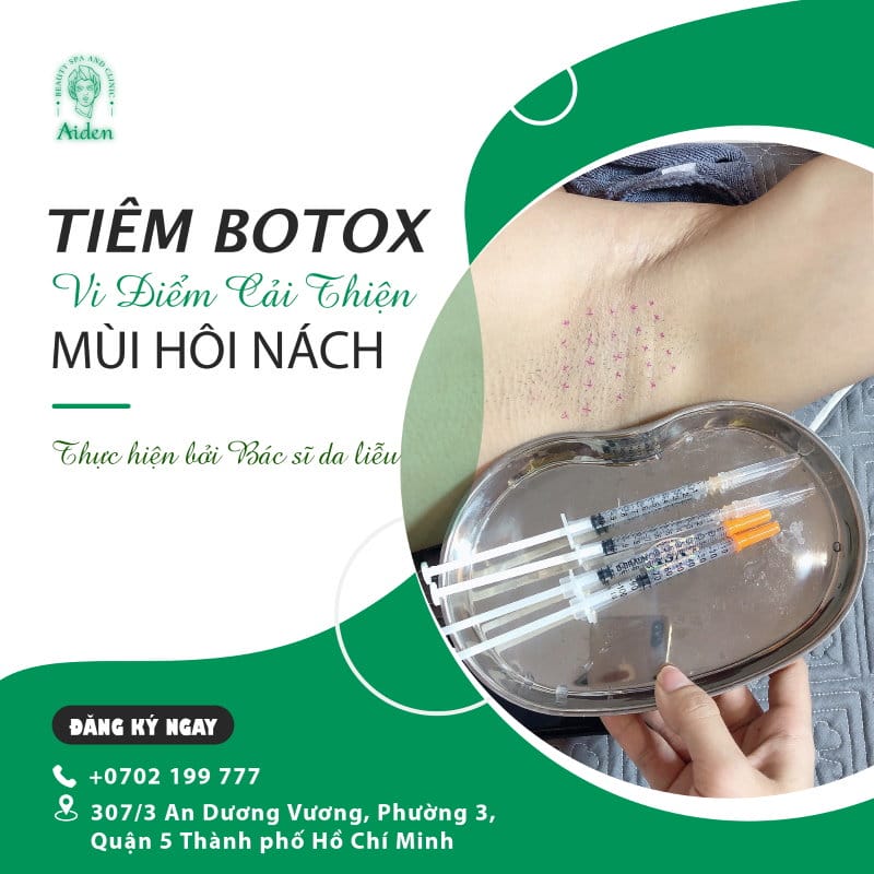 Kết quả tiêm botulinum toxin A cho nách kéo dài bao lâu và cần lặp lại thế nào?