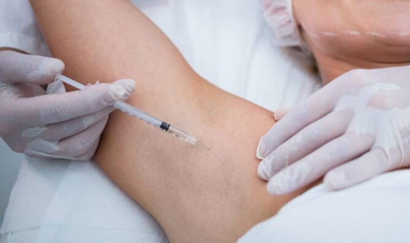 Tiêm botox nách có an toàn không — Rủi ro, tác dụng phụ và chống chỉ định là gì?